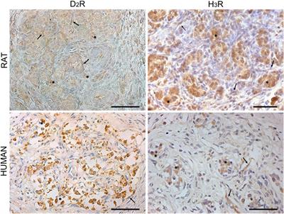 Carotid body plastic behavior: evidence for D2–H3 receptor–receptor interactions